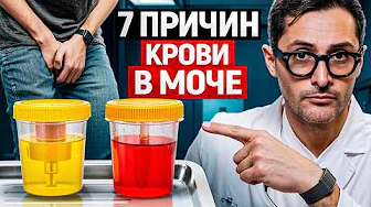 Кровь в моче. Самый опасный симптом, который мужчины игнорируют
