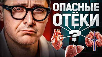 Отёки. Как понять, что это почки, сердце или печень